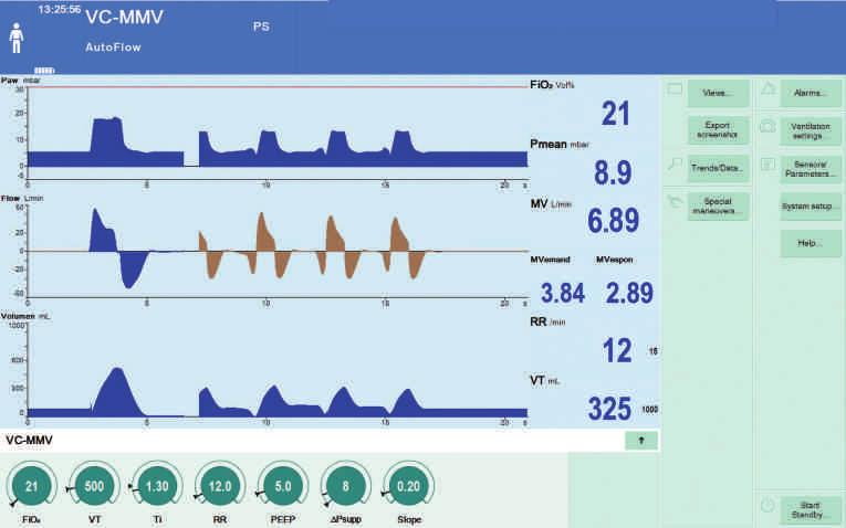 10 VC-MMV + AUTOFLOW AutoFlow (AF), ayarlanmış tidal hacmin (VT) tüm hacim kontrollü, zorunlu solunumlar için gerekli minimum basınçla uygulanmasını sağlar.