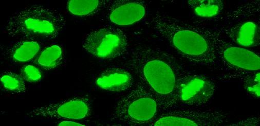 HEp-2 cells PR3