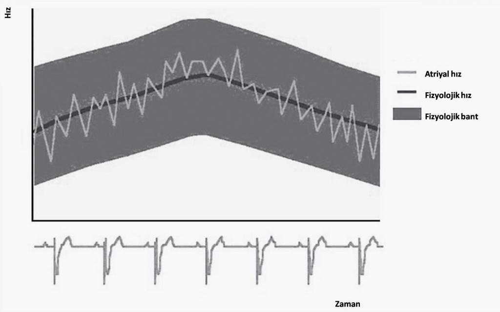 Atriyal Aritmileri Önlemede Koruyucu Atriyal Pacing Algoritmaları 151 ŞEKİL 1 Fizyolojik bant. Fizyolojik kalp hızının 15 atım/dk üstünü ve altını kapsayan bölgeyi gösterir (2).