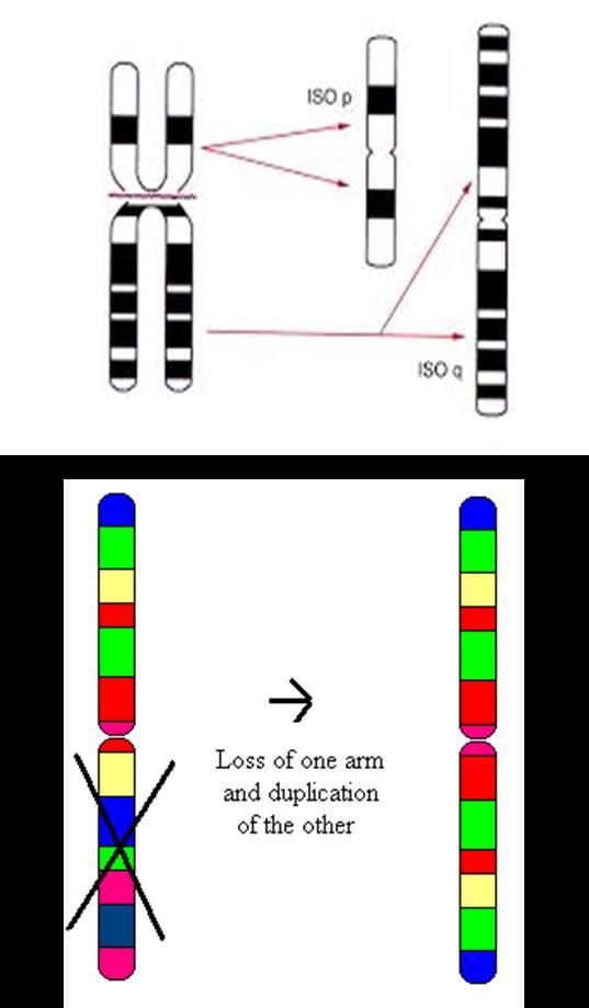 İZOKROMOZOM Kromozom kollarından birisi kaybolur. Diğer kol duplike olur.
