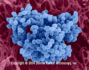 16 Resim 2.2. Enterococcus fecalis bakterisinin SEM görüntüsü [34]. Enterokoklar, laktik asit bakterileri içinde yer alan önemli bir cinstir.