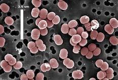 18 2.2.5. Pediocococus cinsi bakterilerin genel özellikleri Pediococcus spp.