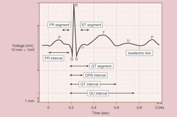 EKG Disritmi Miyokardiyal iskemi Pacemaker Oksijenizasyon bozuklukları Elektrolit değişiklikleri Asit-baz değişiklikleri İlaç etkileri