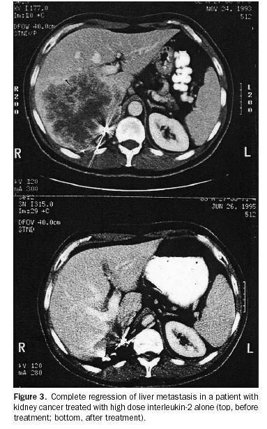 Am Coll Surg 2004 Vol.