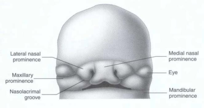 Primer damağı oluşturacak olan yapıların birleşmesinde ortaya çıkan bir aksaklık sonucu çok sık rastlanan konjenital bir deformite olan DUDAK YARIKLARI ve