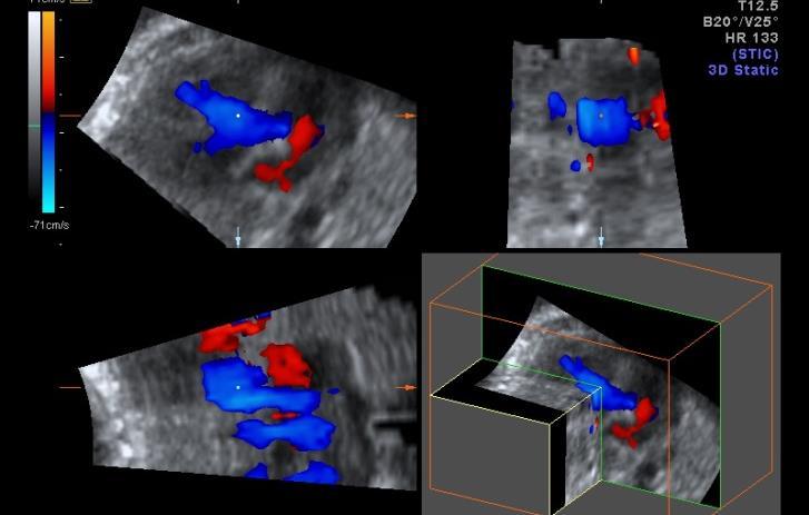 teknolojisi ve renkli doppler niche