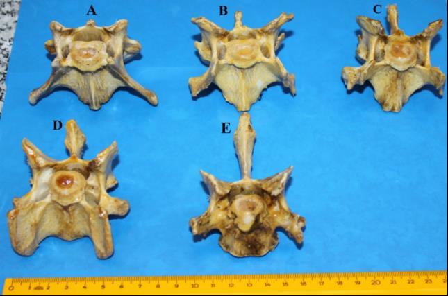 Lumbal omurların cranial (A) ve caudal (B)'den görünümü