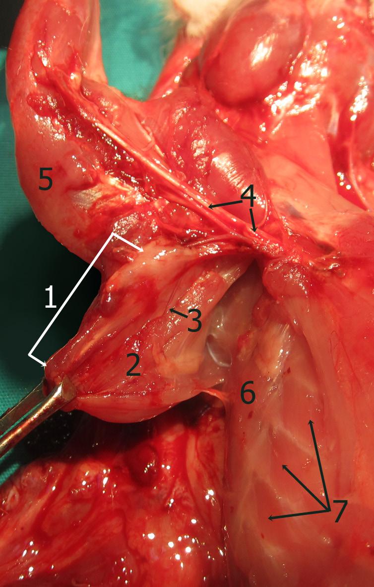 Posterior (arka) duvarı: Üstte m.subscapularis (Şekil 2,3,6-8,11,14-16), altta m.latissimus dorsi nin (Şekil 2-4,6-8,11,14-16), üst kısmı oluşturur. M.