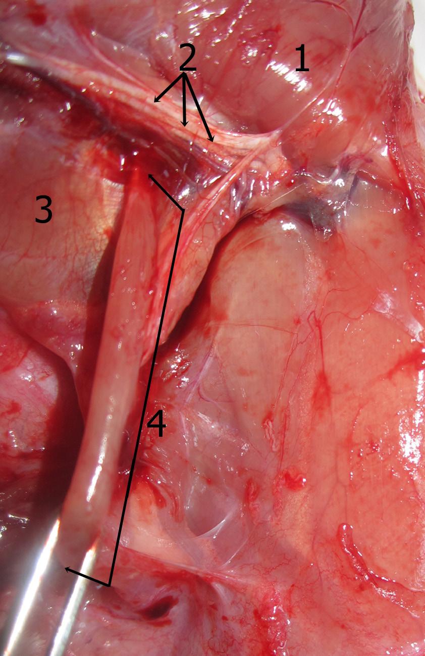 Medial duvarı: 1-4 kaburgalar ve bu kaburgalar arasında bulunan mm.intercostales, ayrıca m.serratus anterior un (Şekil 2,8) üst kısmı oluşturur. Lateral duvarı: Humerus, m.