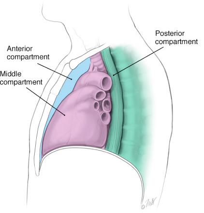 Mediasten anatomisi: Üstte torasik inlet, altta diafragma, önde sternokostal duvar, arkada vertebralar ve kot arkusunun oluşturduğu her iki mediastinal plevra