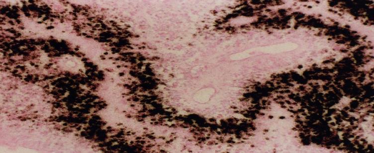 GBM de yüksek düzeyde VEGF eksprese edilmekte Normal doku Pankreatik doku Meme Akciğer (NSC) Kolon GBM Gastrik Karaciğer Böbrek RNA sinyali VEGF Artmış vaskülarizasyondan Artmış damar yoğunluğundan