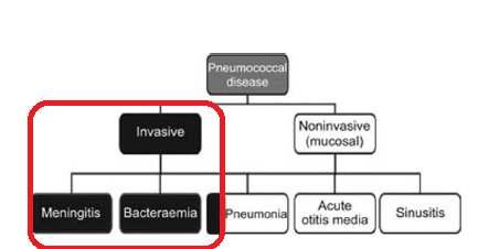 Pnömökoklara bağlı enfeksiyonların sınıflaması