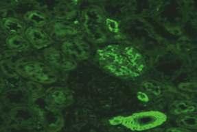 65 99 Resim 7.4.2. Böbrek kesiti (x40) Resim 7.4.4. Karaciğer kesiti (x40) HEp-2 hücresi: Hücrelerin sitoplazmalarında lineer fibriler tarzda boyanma görülür.