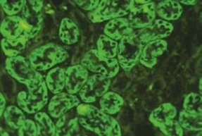 Mide kesiti (x20) İlgili antijenler İlişkili olduğu hastalıklar RAPOR ÖRNEĞİ Sonuç Çalışma yöntemi Çalışılan hücre/doku Referans