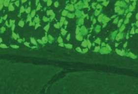 Çalışma yöntemi Çalışılan hücre/doku Referans değer Açıklama/öneri Mide dokusunda bulunan pariyetal hücrelerin sitoplazmalarında
