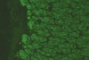 Anti-vimentin antikorları - Maymun midesi (x40) Sıçan midesinde AMA pozitifliğinde de pariyetal hücreler boyanabilir.