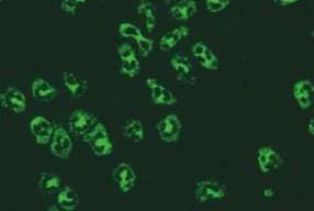 10.3. panca formalin dirençli (MPO ANCA) 10. SİSTEMİK VASKÜLİTLER VE TANIDA KULLANILAN OTOANTİKORLAR Mikroskobik görünüm İlgili antijenler İlişkili olduğu hastalıklar Sonuç Resim 10.3.1. Etanolle fikse granülositler (x40) RAPOR ÖRNEĞİ Çalışma yöntemi Çalışılan hücre/doku Referans değer Açıklama/öneri Resim 10.