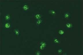 10.5. panca formalin duyarlı 10. SİSTEMİK VASKÜLİTLER VE TANIDA KULLANILAN OTOANTİKORLAR Mikroskobik görünüm İlgili antijenler İlişkili olduğu hastalıklar Resim 10.5.1. Etanolle fikse granülositler (x40) RAPOR ÖRNEĞİ Sonuç Çalışma yöntemi Çalışılan hücre/doku Referans değer Açıklama/öneri Resim 10.