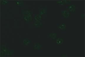 Formalinle fikse granülositler: Floresan boyanma gözlenmez. Etanolle fikse granülositteki floresan görünümünün ANA-nükleer membran pozitifliğinden ayrımı için HEp-2 hücreleri de incelenmelidir.
