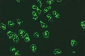 10.7. panca - ANA birlikteliği 10. SİSTEMİK VASKÜLİTLER VE TANIDA KULLANILAN OTOANTİKORLAR Mikroskobik görünüm İlgili antijenler İlişkili olduğu hastalıklar Resim 10.7.1. Etanolle fikse granülositler (x40) Resim 10.