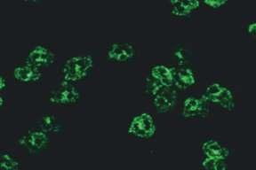 10.9.3. Stoplazmada iri benekli boyanma Mikroskobik görünüm İlgili antijenler İlişkili olduğu hastalıklar Resim 10.9.3.1. Etanolle fikse granülositler (x40) RAPOR ÖRNEĞİ Sonuç Çalışma yöntemi Çalışılan hücre/doku Referans değer Açıklama/öneri 65 125 Resim 10.