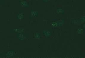 10.10. ANCA negatif örnek 10. SİSTEMİK VASKÜLİTLER VE TANIDA KULLANILAN OTOANTİKORLAR Mikroskobik görünüm İlgili antijenler İlişkili olduğu hastalıklar Resim 10.10.1. Etanolle fikse granülositler (x40) RAPOR ÖRNEĞİ Sonuç Çalışma yöntemi Çalışılan hücre/doku Referans değer Açıklama/öneri Resim 10.