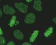 RAPOR ÖRNEĞİ Sonuç Çalışma yöntemi Çalışılan hücre/doku Referans değer Açıklama/öneri ANA: Pozitif (++++) Patern: Yoğun ince benekli (çekirdek granüler + kromozom granüler şeklinde de