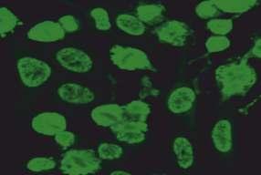 görülmez. HEp-2 metafaz evresindeki hücreler: Negatif Bölünen hücrelerdeki kromatinlerde boyanma gözlenmez.