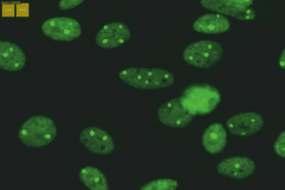 1.4. HEp-2 (x40) HEp-2 interfaz evresindeki hücreler: Pozitif İstirahat halindeki HEp-2 hücrelerinin nükleoplazmalarında otoantikorları gösteren en