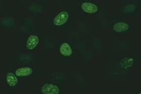 ) HEp-2 interfaz evresindeki hücreler: Pozitif G veya G fazındaki interfaz hücrelerinin nükleusları boyanmamış olabileceği gibi,