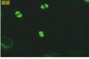 HEp-2 (x40) (MSA-2) Mikroskobik görünüm İlgili antijenler İlişkili olduğu hastalıklar RAPOR ÖRNEĞİ Sonuç Çalışma yöntemi Çalışılan hücre/doku