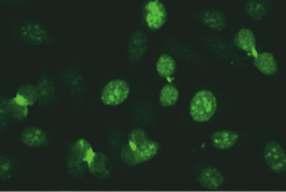 5.2.3. Anti-intrasellüler köprüler (midbody) benzeri boyanma Resim 5.2.3.1. HEp-2 (x40) Resim 5.2.3.2. HEp-2 (x40) Mikroskobik görünüm İlgili antijenler İlişkili olduğu hastalıklar RAPOR ÖRNEĞİ Sonuç