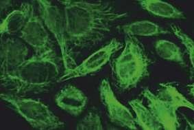 Fibriller hücre nükleusuna yakın olan bölgelerde daha yoğundur.