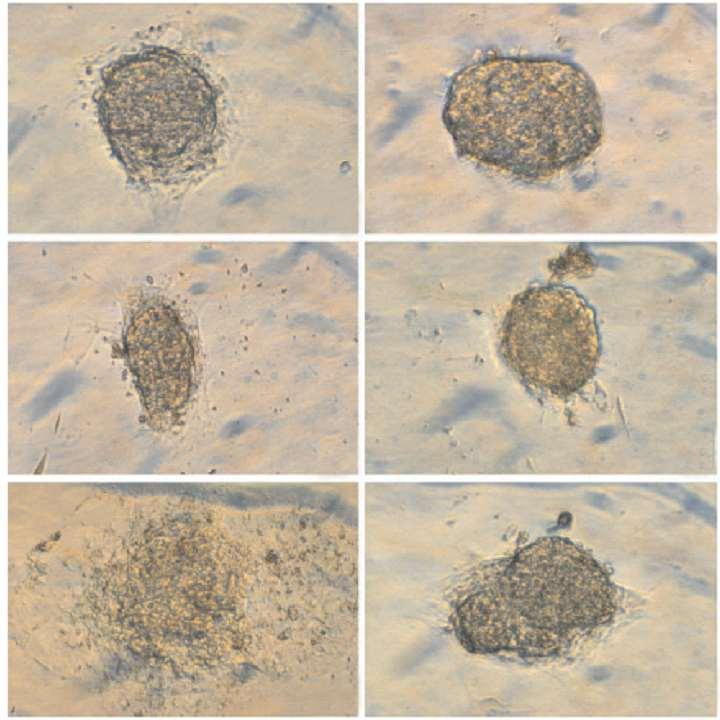 GLP-1, In Vitro İnsan Adacık Hücre Morfolojisini Korur GLP-1 olmadan kültüre edilen pankreas adacıkları daha ilk günden organizasyonlarını kaybederler. Kontrol GLP-1 5.