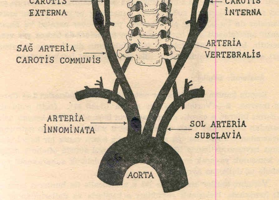 Arter (VBA) AKİ dan Arteria Serebri Media (ASM)