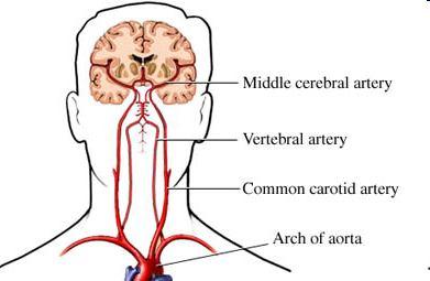 Vertebral Arterler ve Basiller Arter