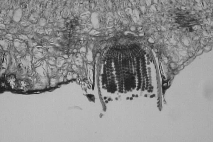 Ezidiospor Puccinia gramiste görülür.