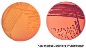 Enterobakteriler Kültür vasatı: Kanlı agar EMB,
