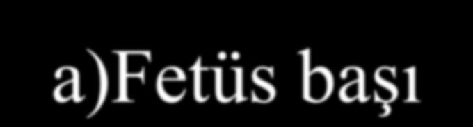 a)fetüs başı Fetüs başı, normalde gövdeden daha büyük olması nedeni ile, doğum mekanizması yönünden en önemli