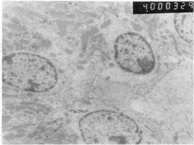 Proksimal tübül, tek katlı apikal yüzeyleri bol miktarda mikrovillus içeren hücreler ile alttaki bazal membrandan oluşuyordu. Her proksimal tübül hücresi tek, oval, ökromatik bir nükleusa sahipti.