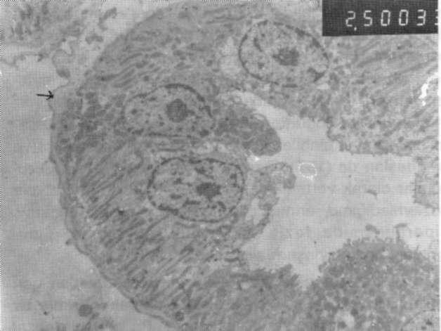 Proksimal tübül. Bazal membran kalın (okla işaretli), bazı hücrelerin sitoplazmalarında az miktarda vakuoller (V) ve seyrek lizozomlar (L) izlenmekte.x2500 Şekil 5.