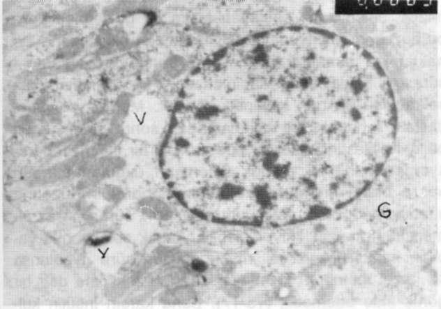 Distal tübül. Bazal membran yer yer kalın (okla işaretli). Hücrelerin sitoplazmalarında lizozomal yapılar yok, vakuoller seyrek.