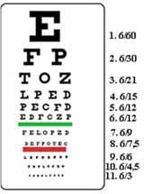 uşaqlar başlarını çox aşağı əyməsinlər (c). Uzaqdangörmə. Uzaqdan görən gözün optik sisteminin fokusu tor təbəqəsində deyil, ondan arxada yerləşir.