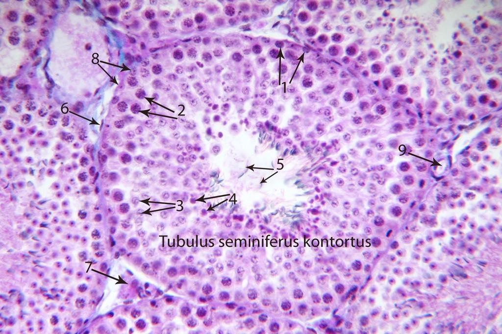 Seminifer tubulusların aralarında bağ doku içinde iç salgı karakterli