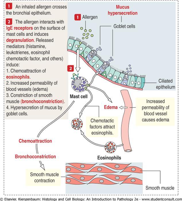 Astımda mast hücre -eozinofil etkileşimi 1.Solunan hava ile alınan antijen solunum epitelini geçer 2.Antijen mast hücre yüzeyinde bulunan IgE reseptörlerine bağlanır.