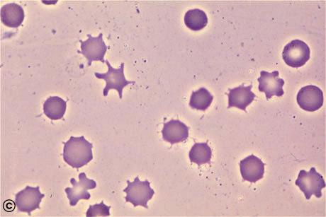 Called Spur Cells, Occur in