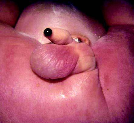 Rektoüriner fistül (üretrada mekonyum) ARM li erkek bebeklerin üretrası da mekonyum gelip gel ediği e veya çok az