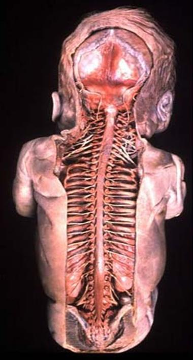 Medulla Spinalis Gelişimi Medulla spinalis(ms)