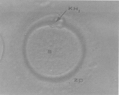 spermiumlarý ile insemine edildiler ya da erkek faktörü varsa mikroenjeksiyona tabi tutuldular (Þekil 3).