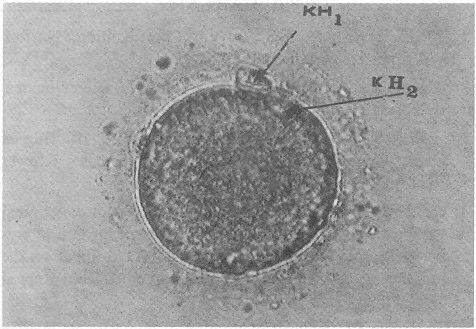 A: 12 saat sonra germinal vezikül kaybolmuþtur (alttaki oosit). B: 22 saat sonra 1. kutup hücresi (KH1) atýlmýþtýr. (c) (a)'daki oositin 26. Saatteki TII durumunu gösteren mikrograftýr. 2. kutup hücresi de atýlmýþtýr.